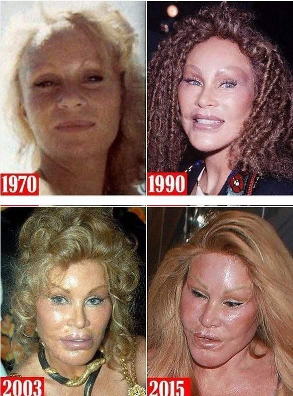 明星整容背后的故事與友情力量揭秘